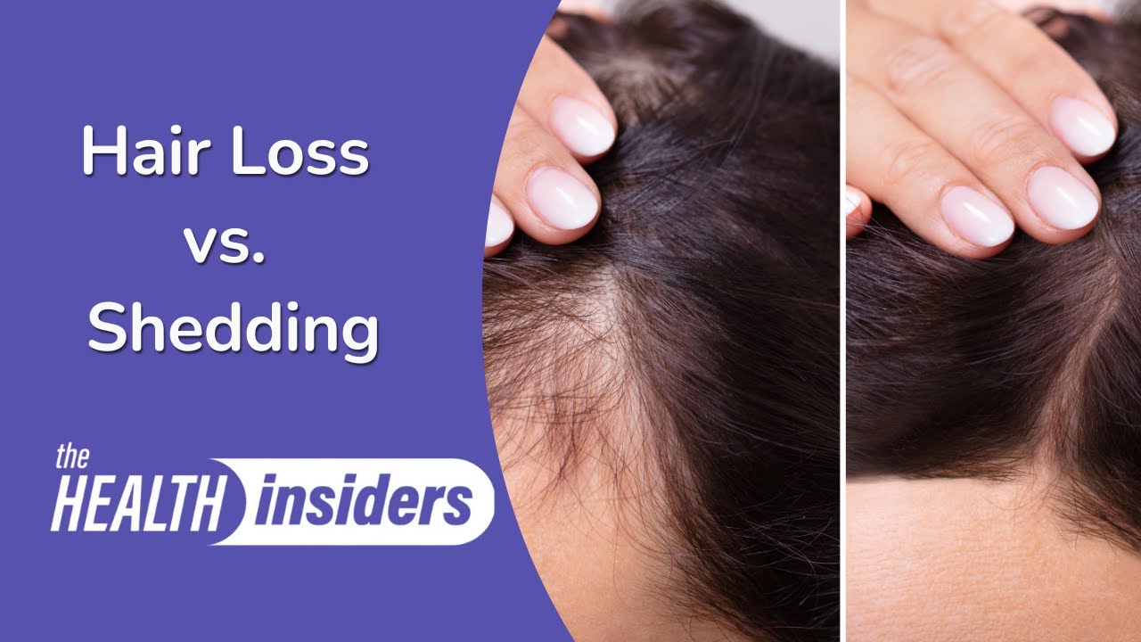 Hair: Loss vs. Shedding