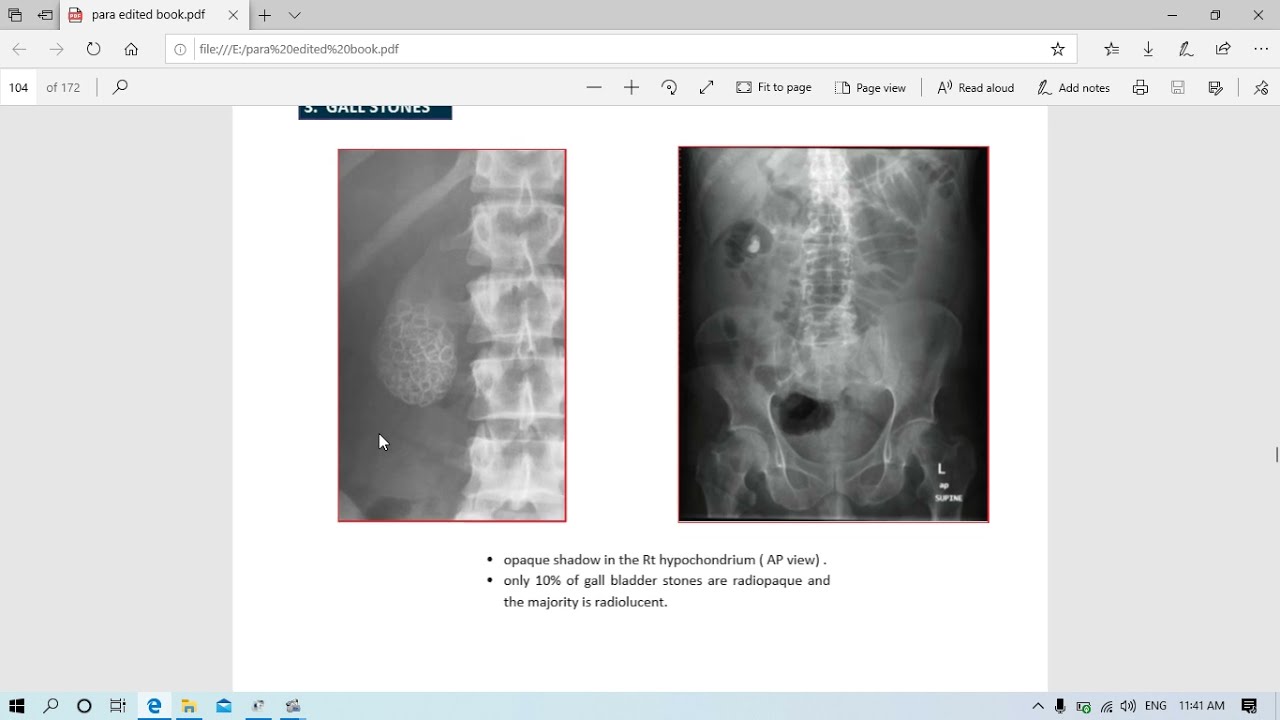 Radiology - 4 Abdomen- Dr Mahmoud Allam