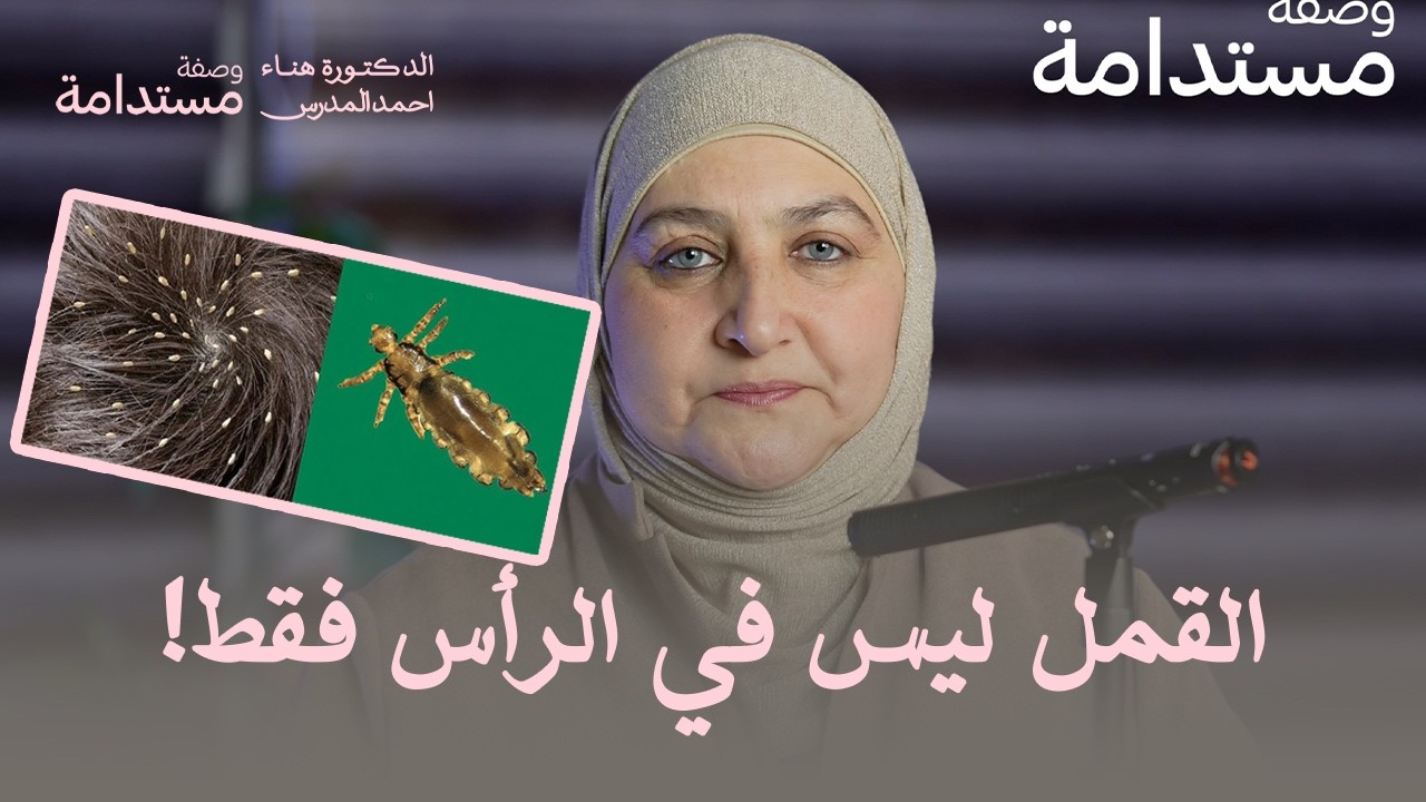 القمل ليس في الرأس فقط! الحقيقة التي يجهلها كثيرون