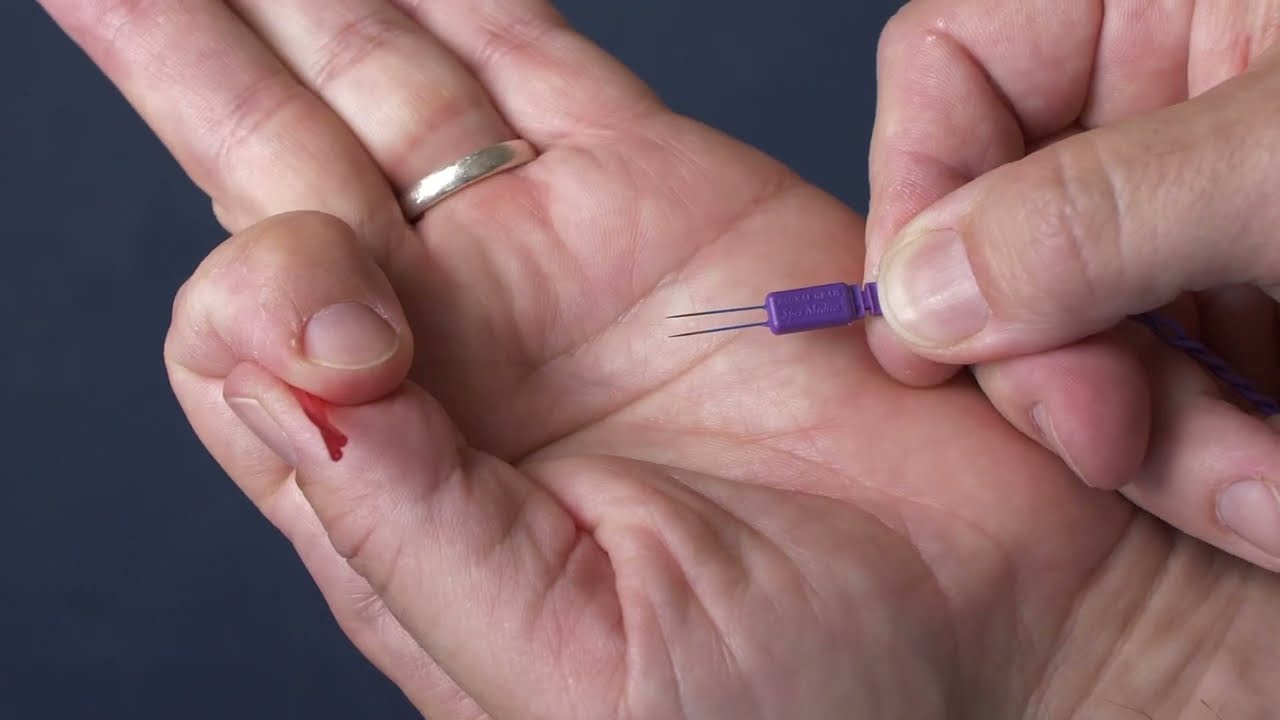 Mastodon Paired Needle EMG Electrodes In-Service Guide | Facial Nerve Monitoring