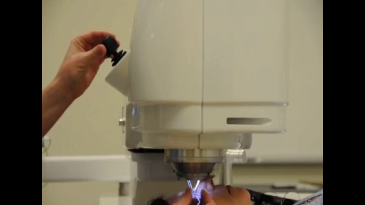 Intralase Training Video Docking