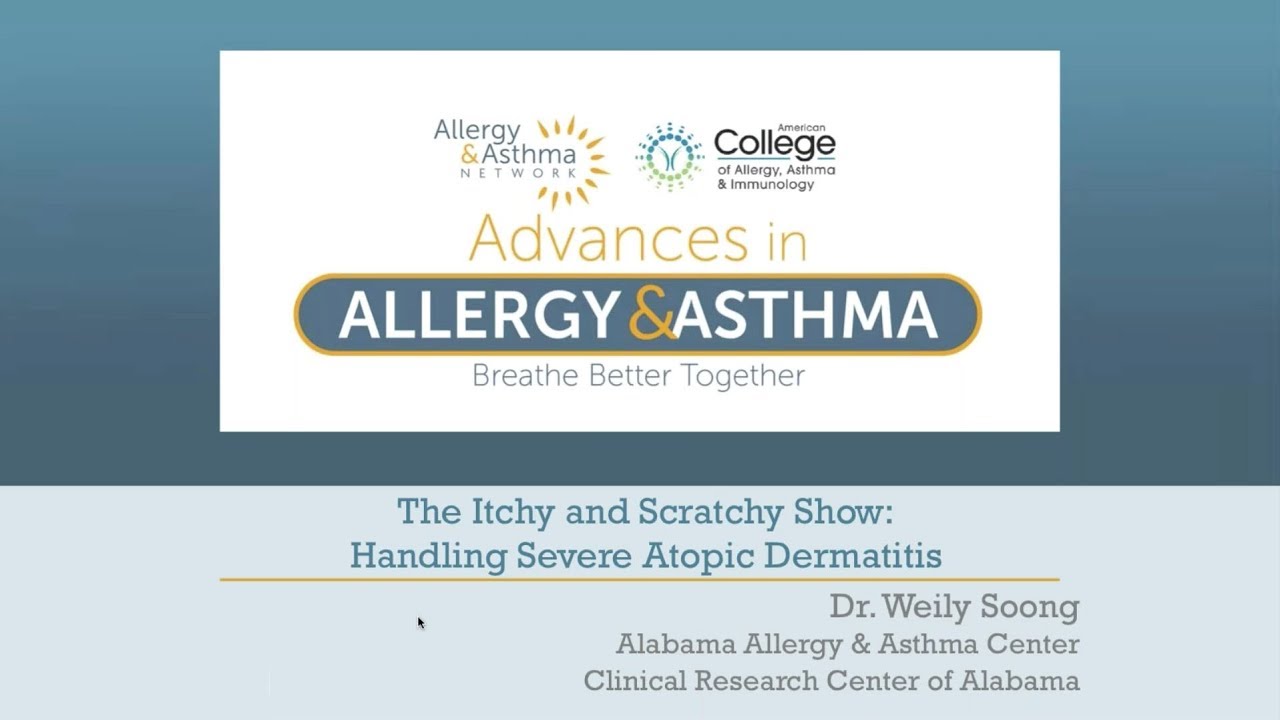 The Itchy and Scratchy Show:  Handling Severe Atopic Dermatitis