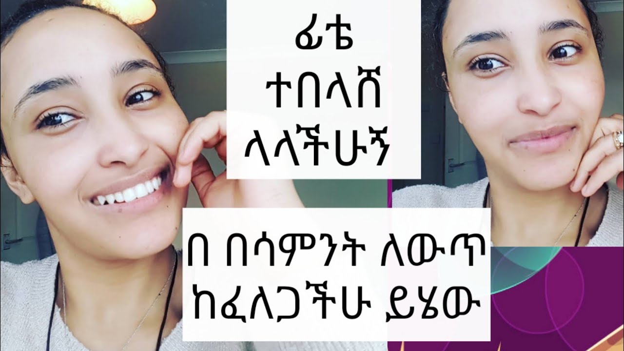 የፊቴ ሚስጥር ይሄው ሞክሩት 
በሳምንት ለውጡን ታዩታላችሁ