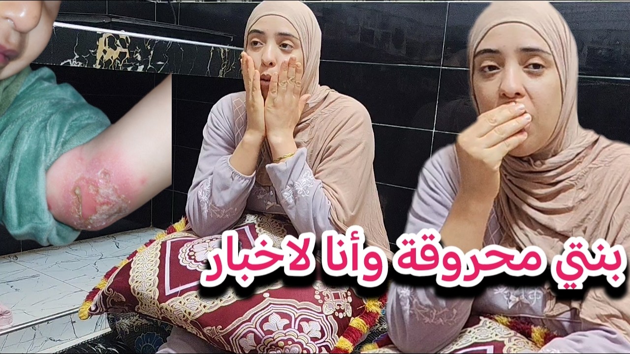 بسباب دوش عرفت بنتي محروقة😢رديت البال حتا عييت والحاضي هو الله 🤲