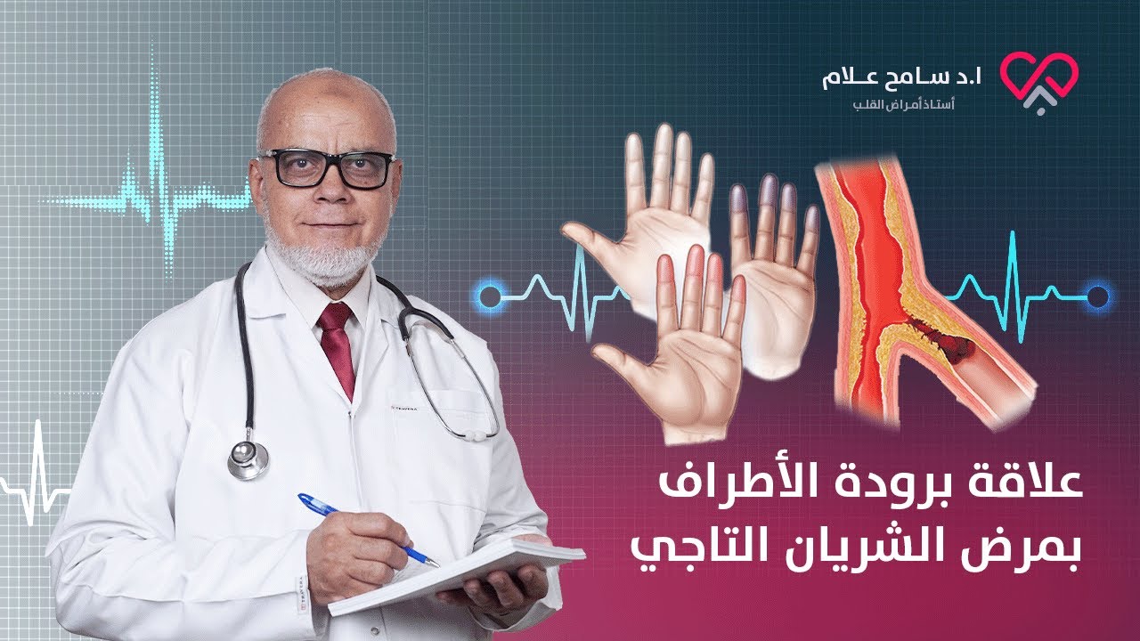 🥶 برودة الأطراف من اعراض الشريان التاجي وايه افضل طرق العلاج؟ | دكتور سامح علام