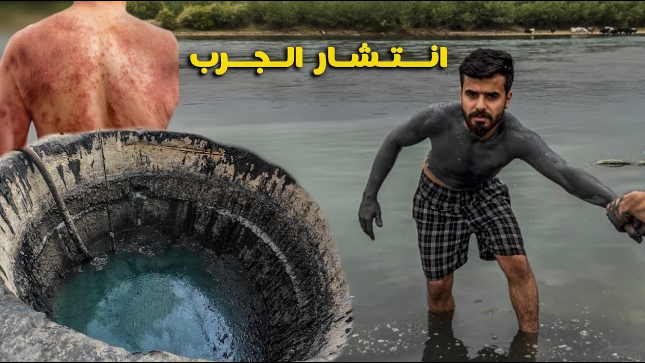 سبحت بالكبريت جسمي احترق 🔥 جولة 24 ساعة الموصل