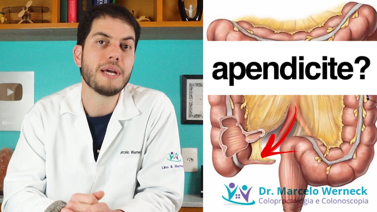 O que &eacute;? O que &eacute; apendicite?