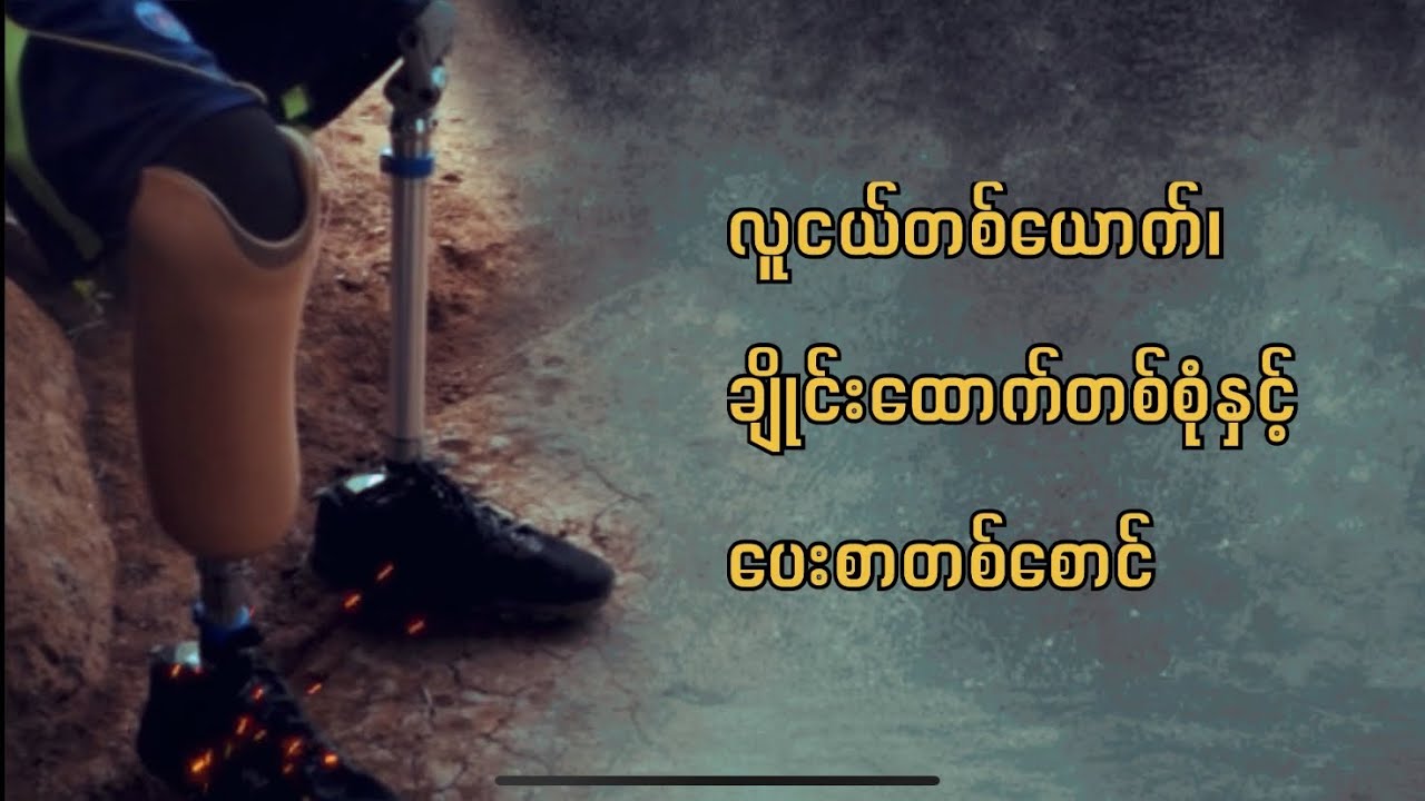 လူငယ်တယောက် ဂျိုင်းထောက်တစုံနှင့် ပေးစာတစောင် - သင့်သူ