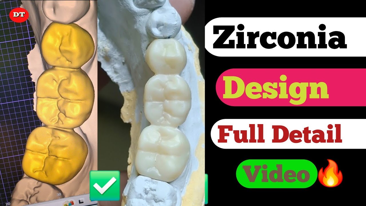 Zirconia Design Full details video| Exocad design| Posterior zirconia design| monolith design| Lab