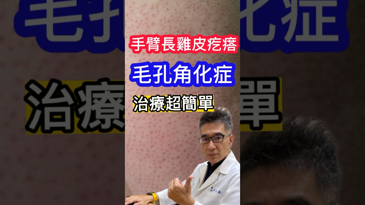 手臂長 #雞皮疙瘩 #毛孔角化 #皮膚科醫師 告訴你 治療超簡單#吳仁欽皮膚科診所 #果酸 #水楊酸 #皮秒雷射 #第四代A酸 #Aklief #艾克痘 #醫皮痘 #Epiduo #青春痘 #粉刺