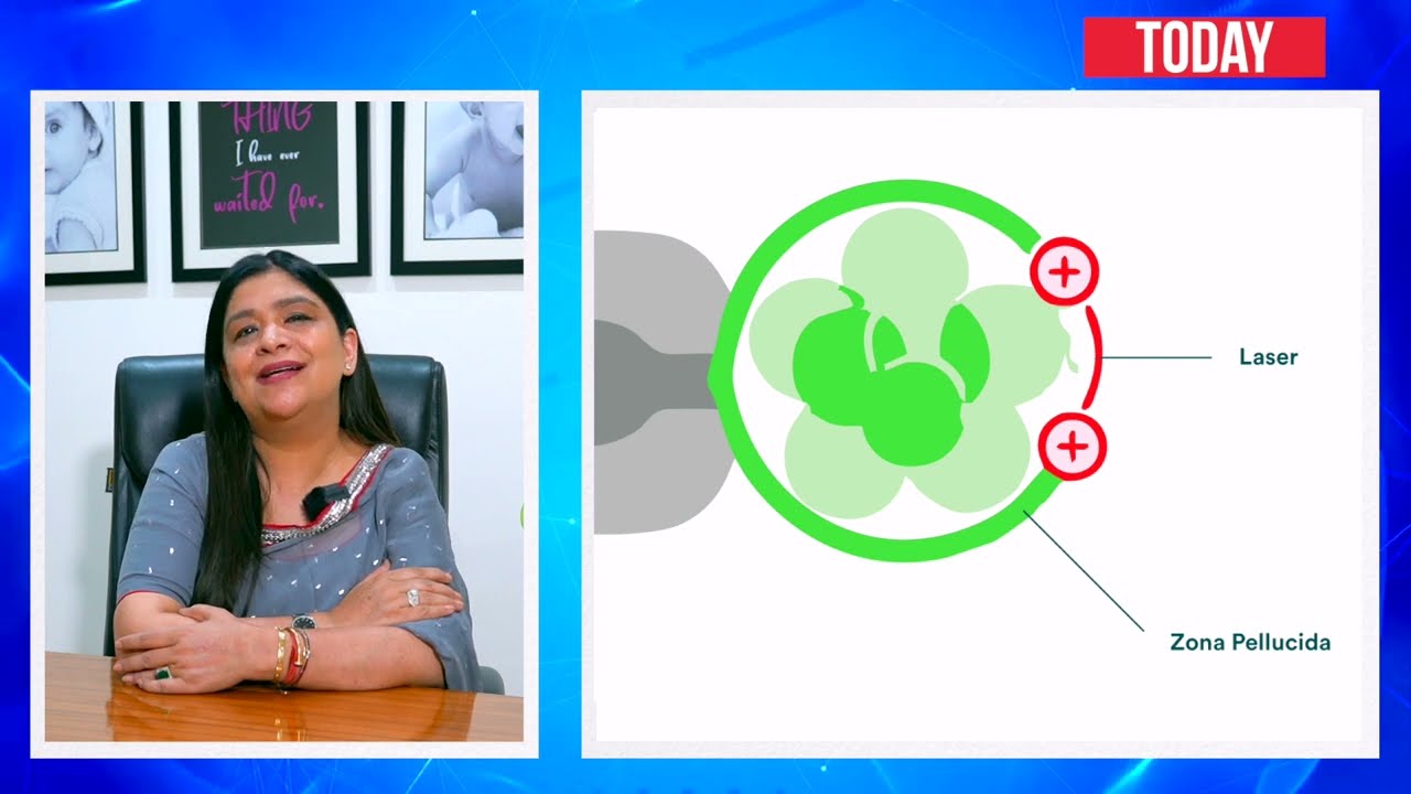 Making IVF 100% Successful with Laser Assisted Hatching.