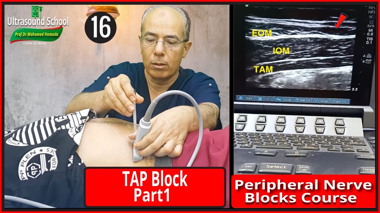 TAP Block part1)Ultrasound Guided peripheral Nerve Blocks Course |Mohamed Hamada|(16)