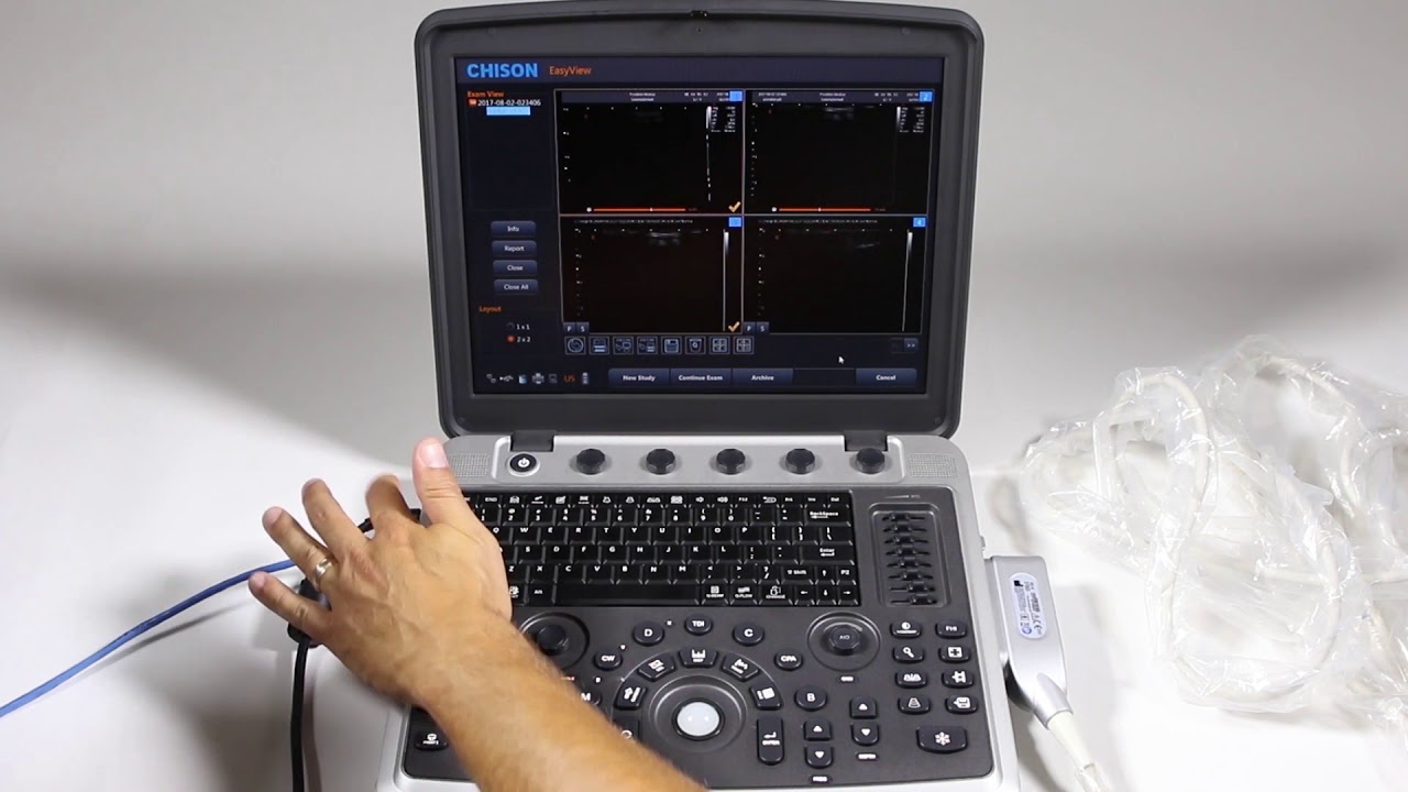 Chison SonoBook 9 Training Part 5: Exporting, Image Review & Reports