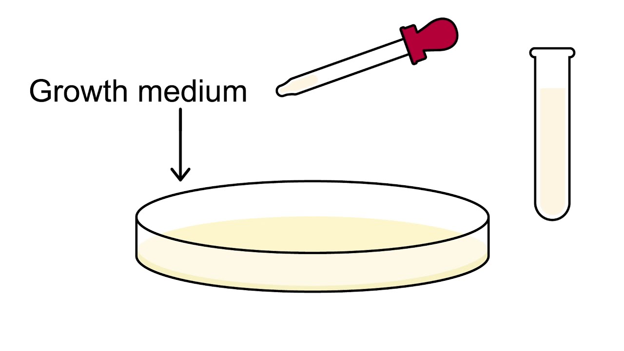 How do you count the Lactobacillus casei strain Shirota in Yakult?