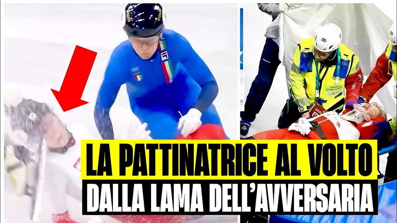 TERRORE ALLE OLIMPIADI: LA PATTINATRICE SELLIER COLPITA AL VOLTO CON LA LAMA. HA RISCHIATO L'OCCHIO
