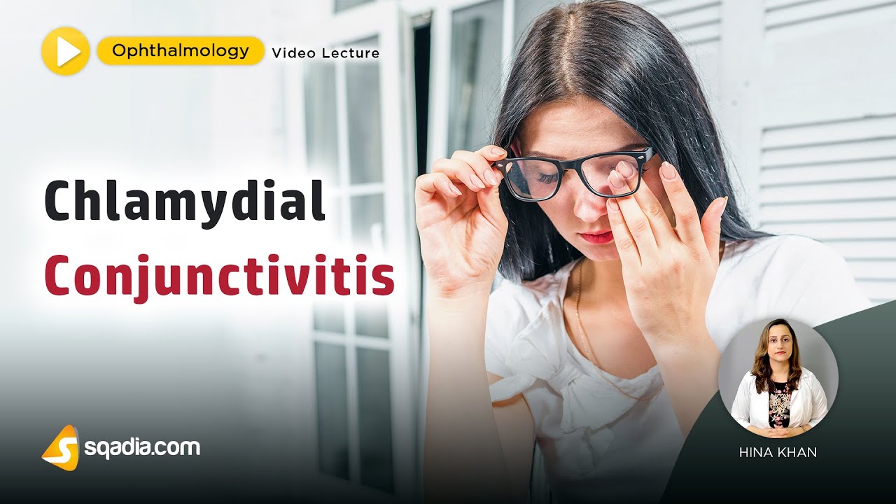 Chlamydial Conjunctivitis | Ophthalmology Lecture | Medical Student V-Learning