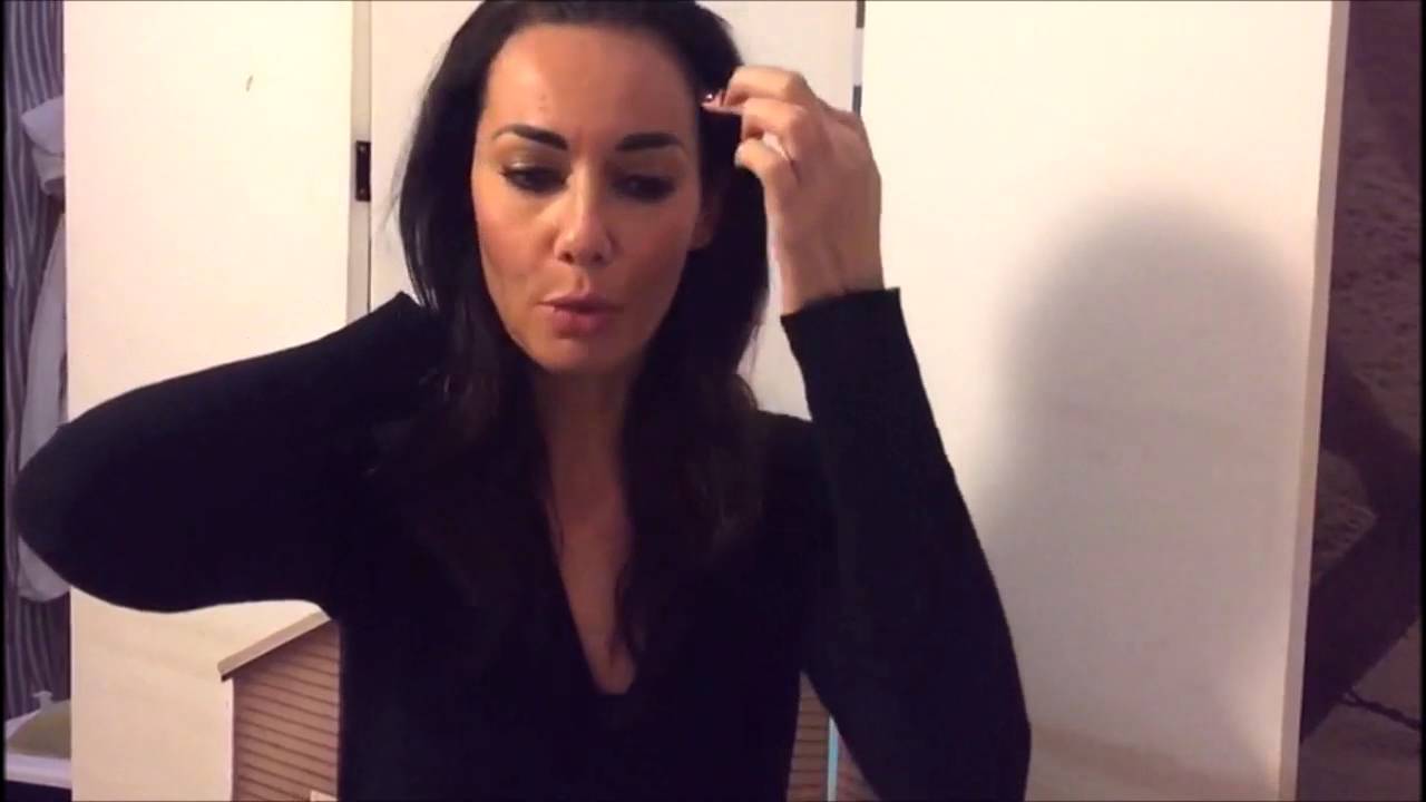 TRATTAMENTO MICRONEEDLING:  il mio parere