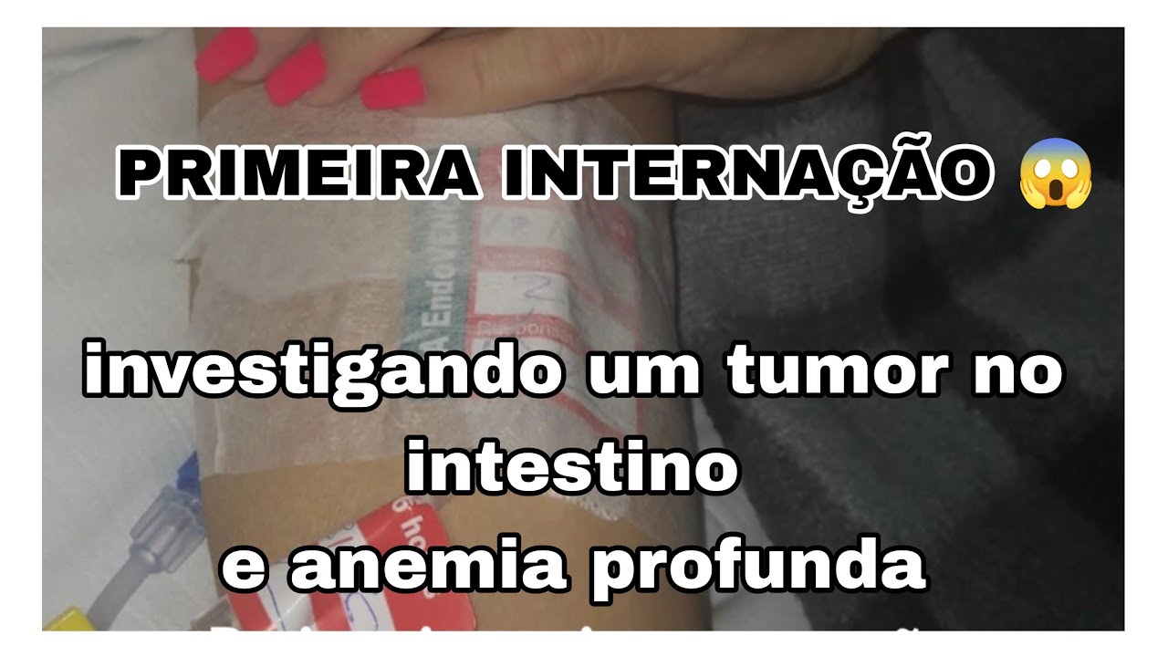  Apareceu um Tumor no meu intestino  Anemia profunda precisei de transfusão de sangue Dias difíceis 