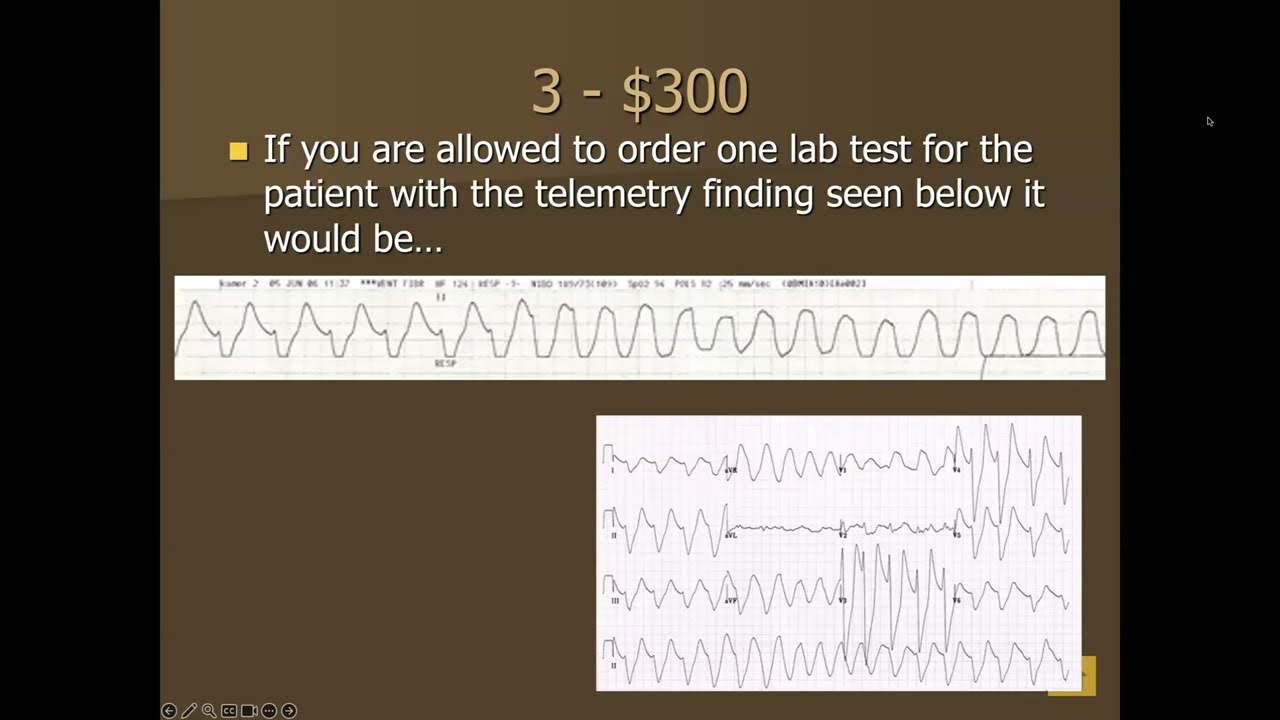 Ep13 Arrhythmia Basics - Lives in Jeopardy! - Dr. David Singh - The Scheinman Foundation
