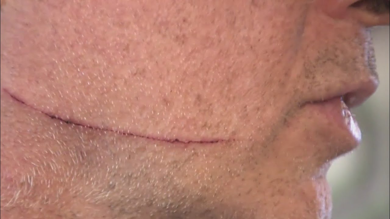 Victim of Penn Station stabbing speaks out