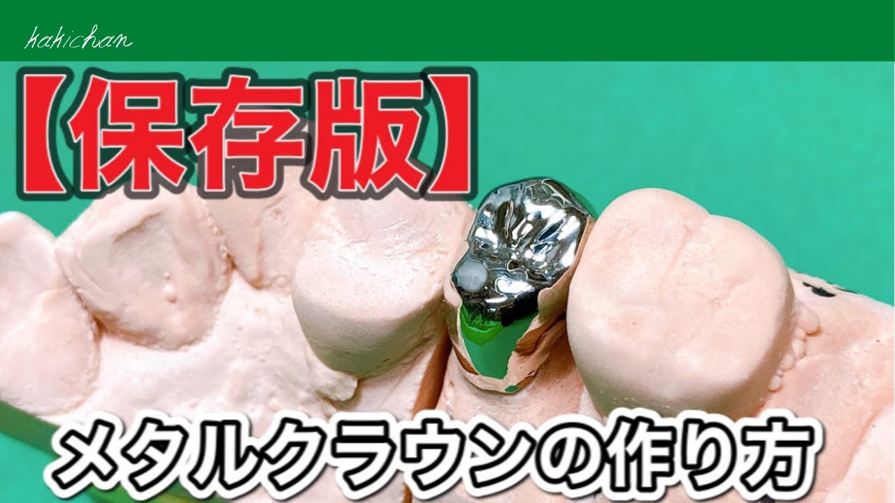 【歯科技工士】クラウンの作り方、ワックスアップから研磨まて若手歯科技工士向けに解説