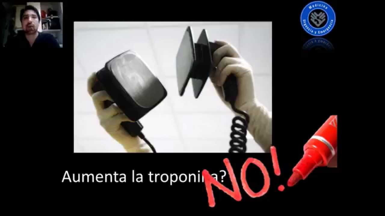 Cardioversio electrica y desfibrilacion, Aumentan troponina? #FOAMed #MUE #ChileEM