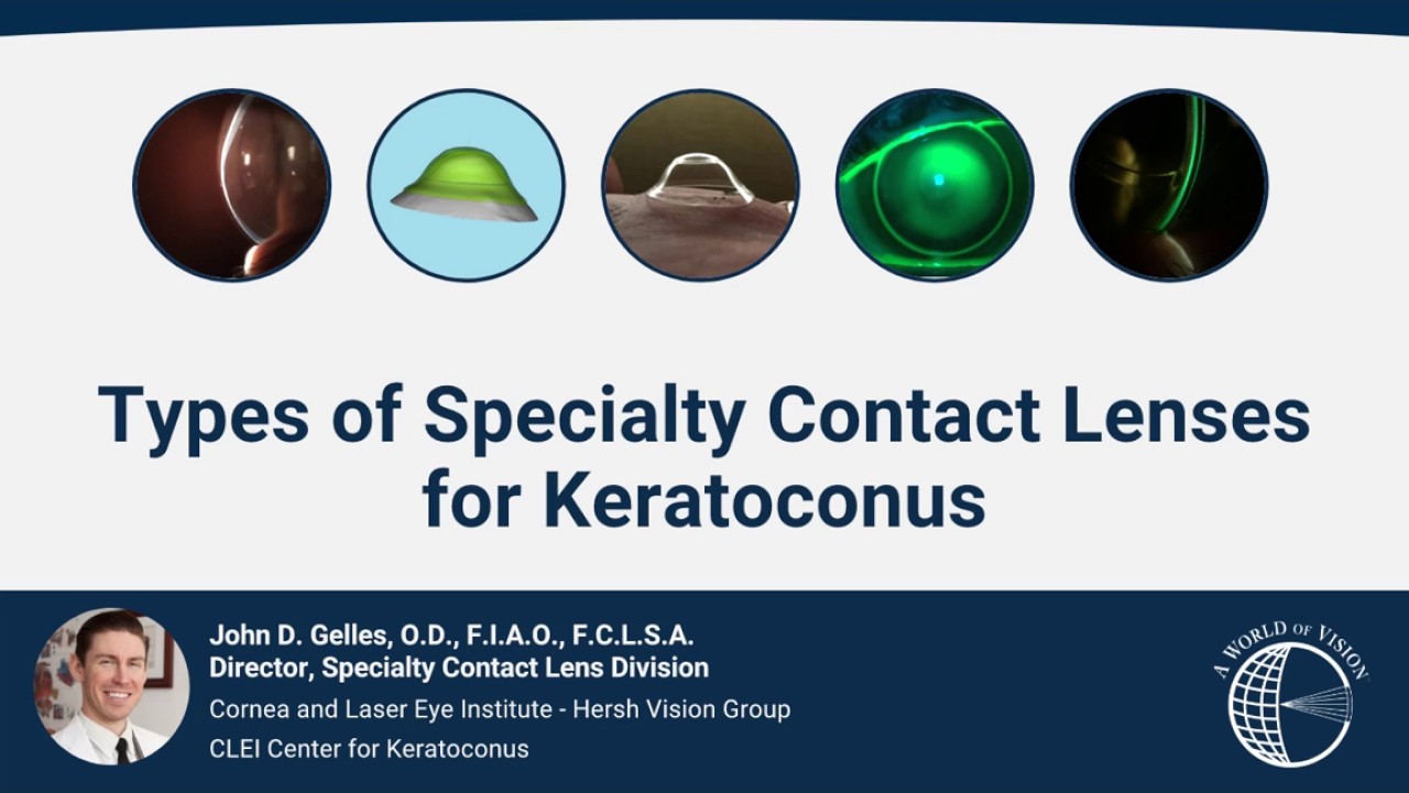 CLEI Center for Keratoconus - Types of Specialty Contact Lenses for Keratoconus - Episode 8
