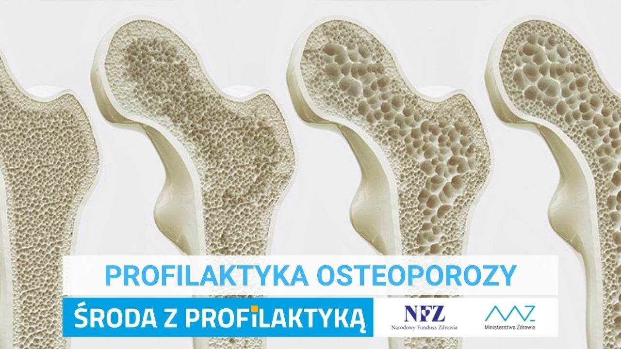 Profilaktyka osteoporozy
