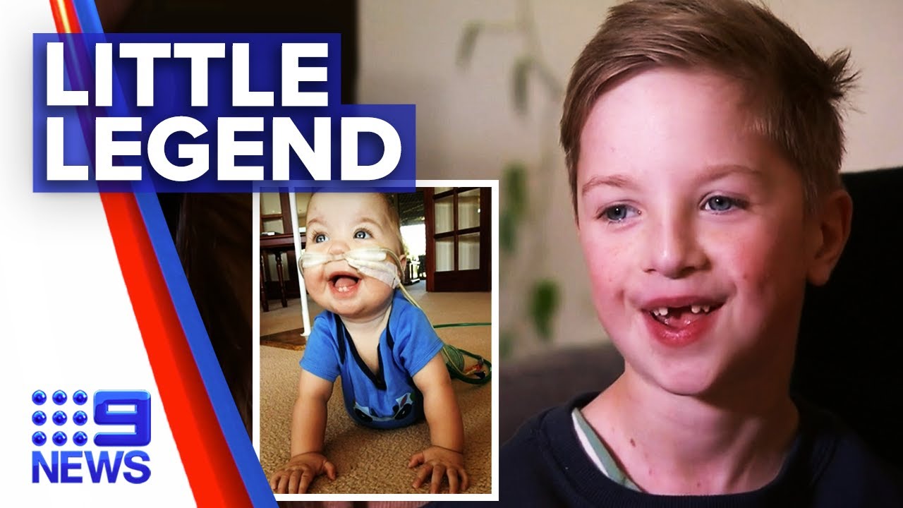 Boy born with organs outside body to undergo surgery | 9 News Australia