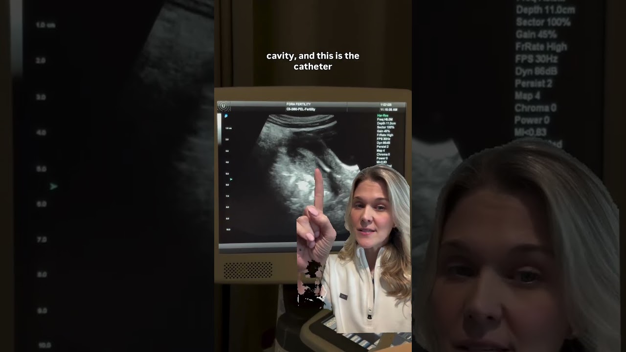 День переноса эмбриона &mdash; волнующий момент.