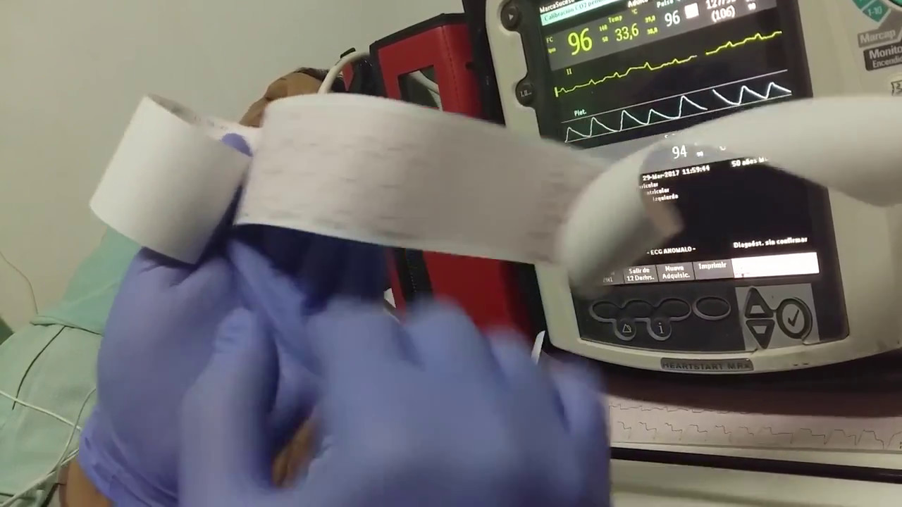 PHILIPS HEART START  MRX   Desfibrilador Monitor Multiple Paramétrico Hospital Cafayate