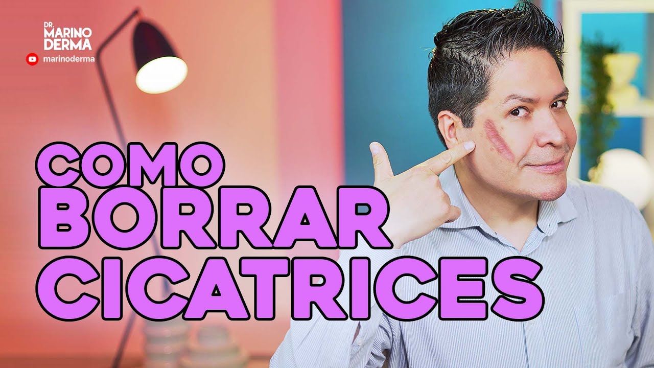 COMO BORRAR CICATRICES - RECOMENDACIONES DE UN DERMATOLOGO