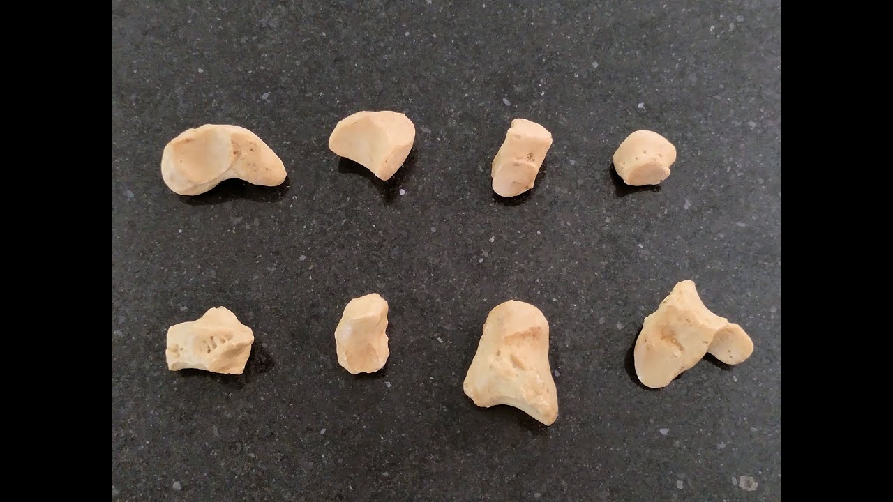 Carpal Bones - Identification