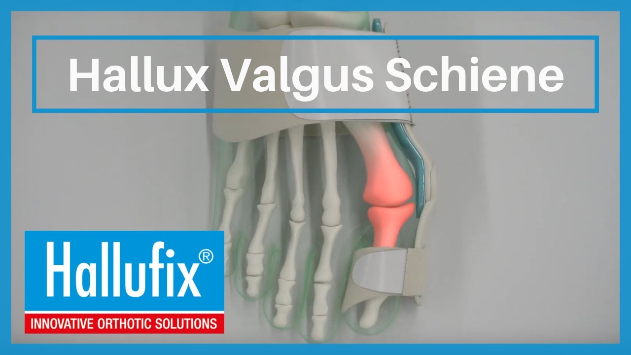 Hallufix&reg; Hallux Valgus Schiene