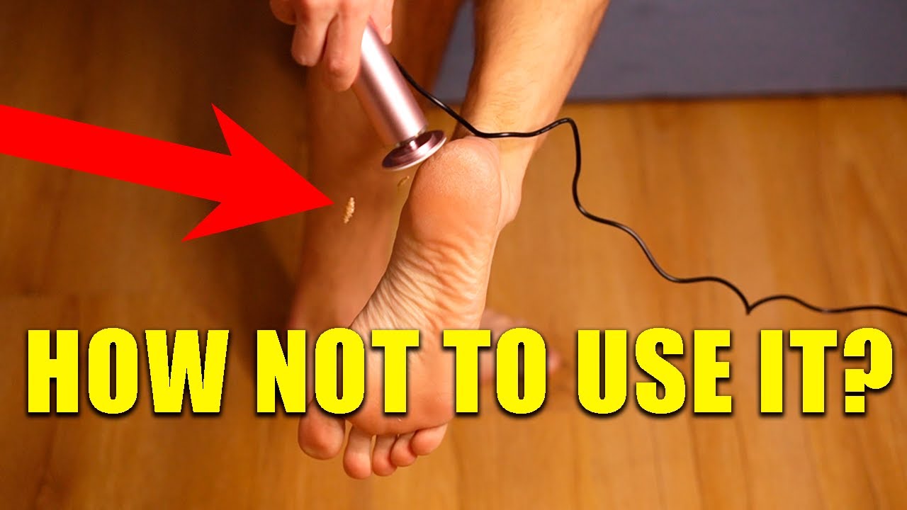 Dermave Electric Foot Callus Remover Review - Does It Really Work? How To Use It Effectively?