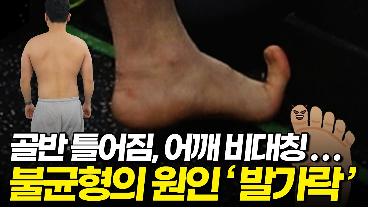 엄지발가락 하나 때문에 몸이 이렇게 꼬인다고? ㄷㄷ