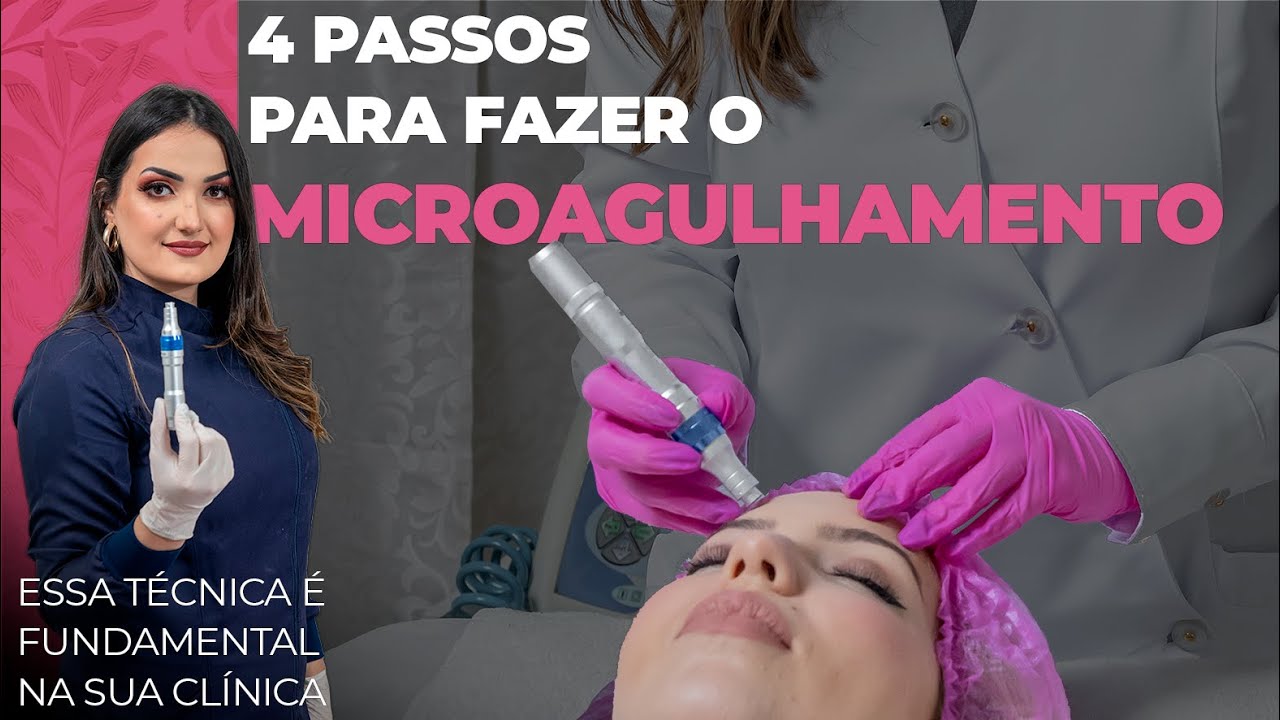 Como fazer o MICROAGULHAMENTO usando a Dermapen
