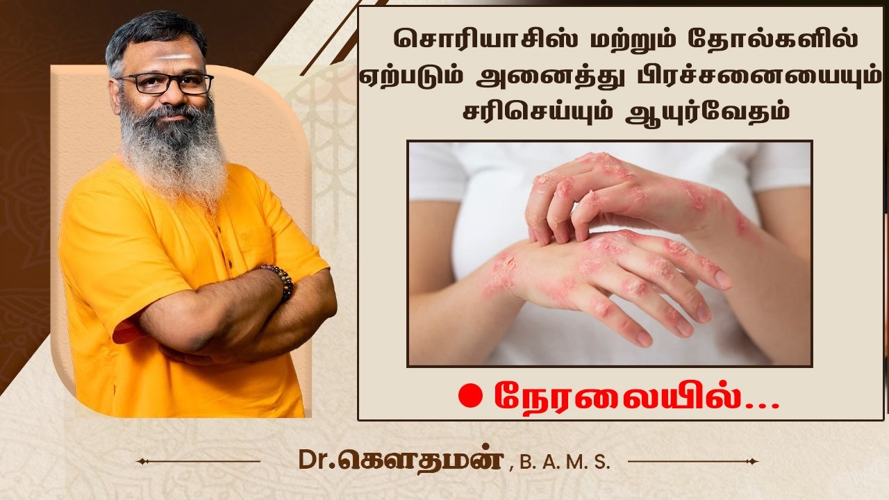 🛑 LIVE | சொரியாசிஸ் முழுவதுமாக சரிசெய்ய முடிமா? முழு நேரலை விளக்கம் | SHREEVARMA | Dr Gowthaman