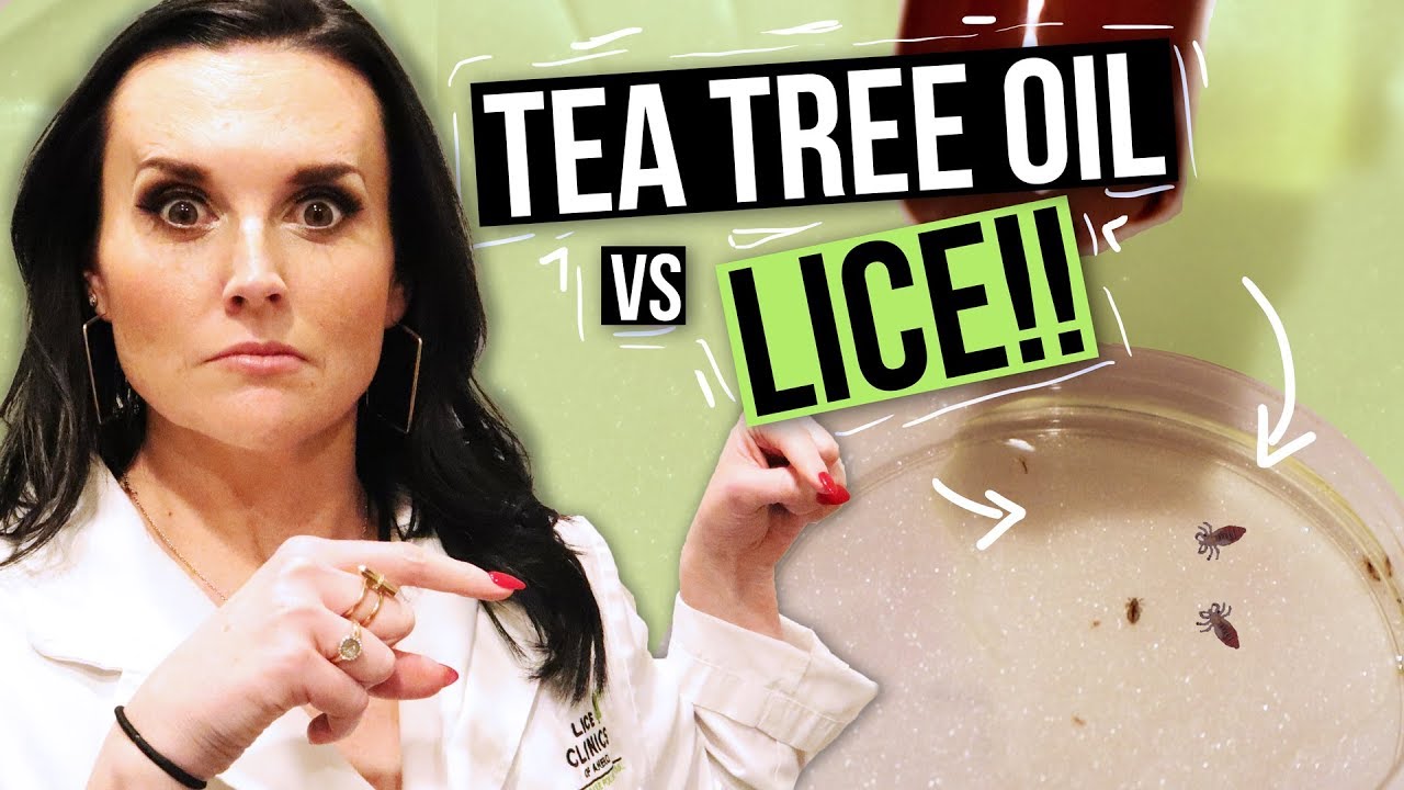 Removing LICE with TEA TREE OIL? - Watch this Before You Try!