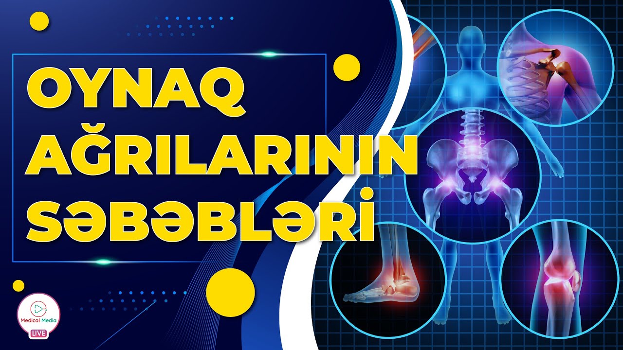 OYNAQ AĞRILARININ SƏBƏBLƏRİ / OYNAQ AĞRILARI ZAMANI NƏ ETMƏLİ