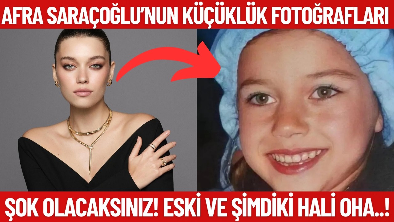 Детские фотографии Афры Сарачоглу! Вы будете шокированы! Вот эти фотографии!