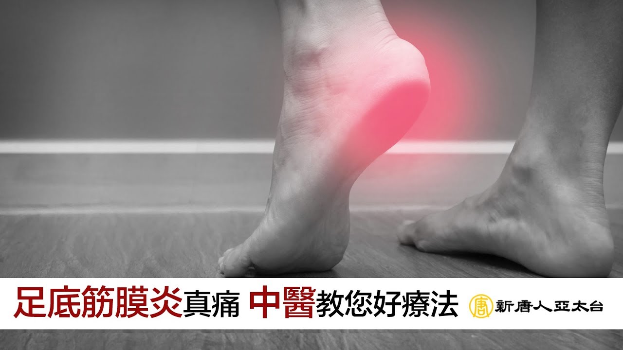 淺談舉步維艱的『足底筋膜炎』中醫治療有法寶 | 談古論今話中醫(451)