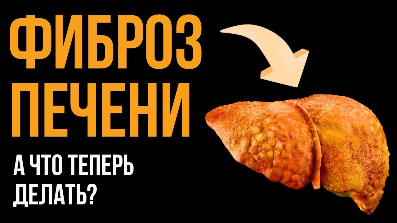 ФИБРОЗ печени: что не дает печени нормально работать и насколько это опасно?