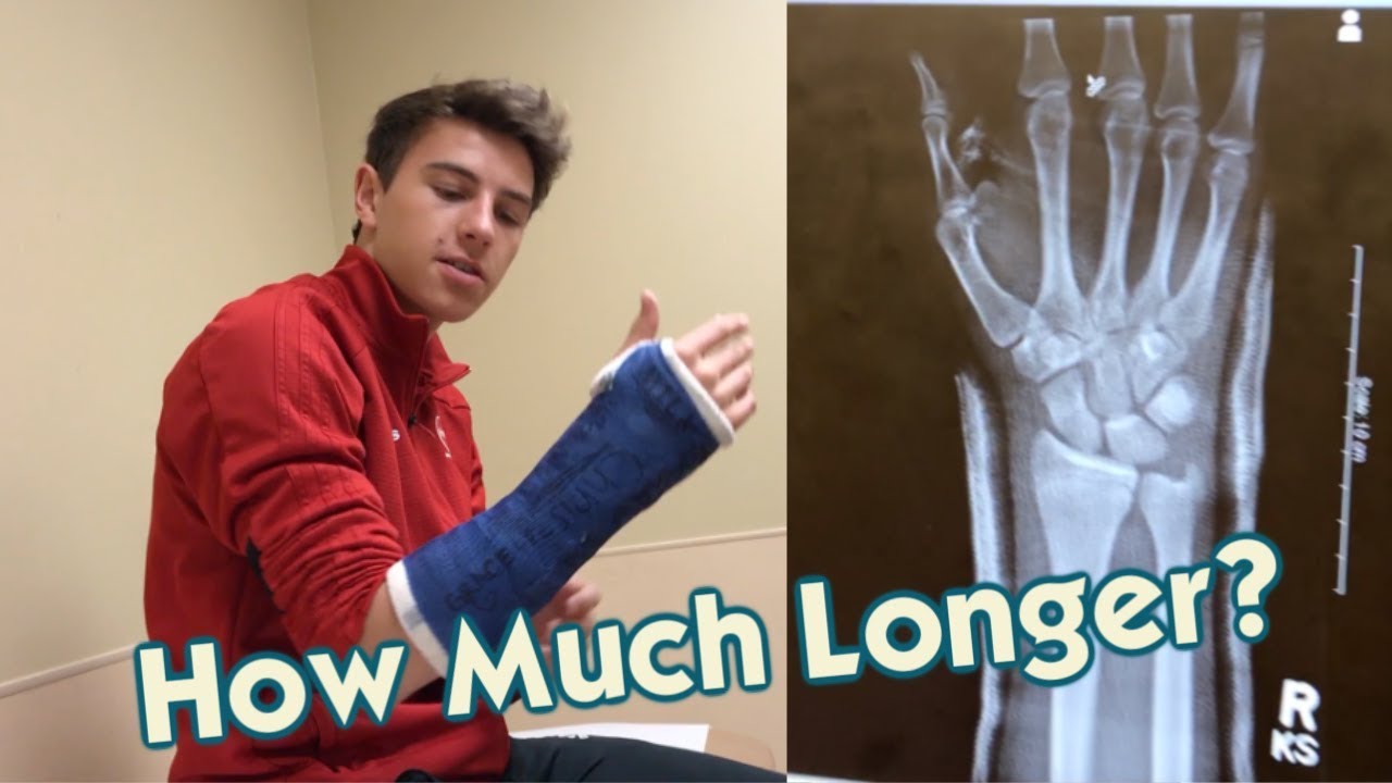 It's Back At The Doctor's Office for His Broken Arm- How Much Longer?