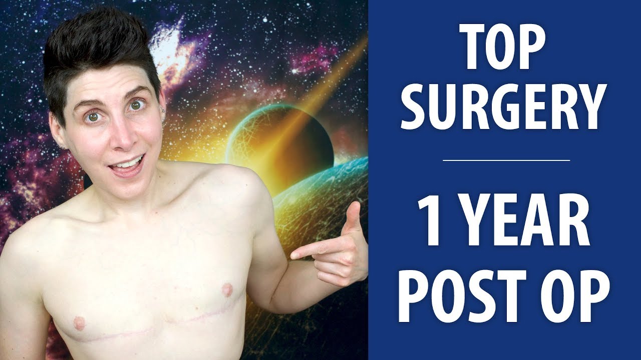 1 Year Post Op (Dr. Garramone) | Nonbinary Top Surgery