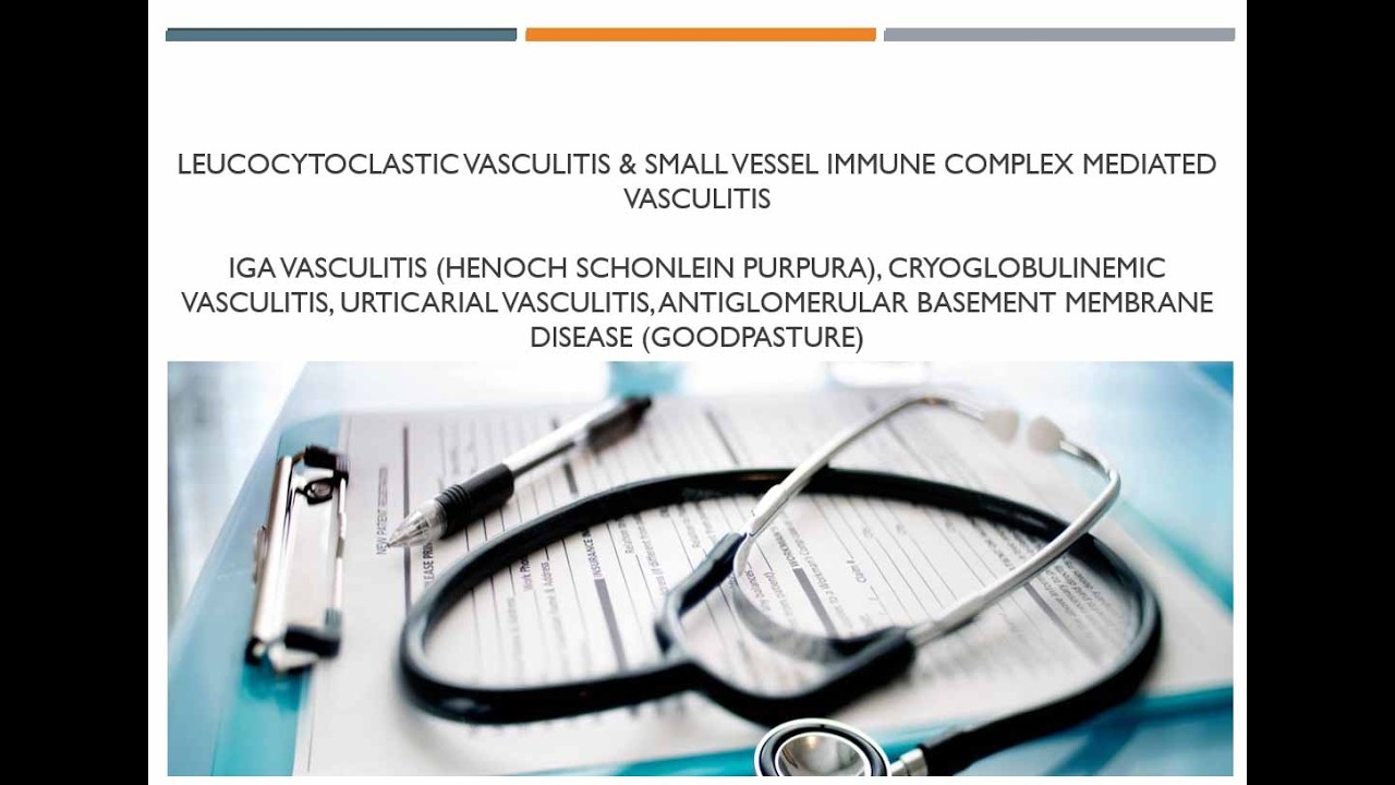 21 Leucocytoclastic Vasculitis, Henoch Schonlein Purpura, Urticarial Vasculitis, Cryoglobulinemia