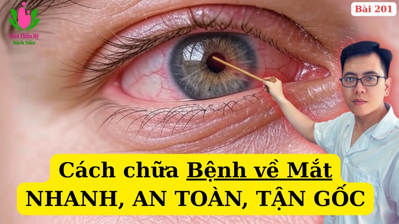 Cách chữa MỜ MẮT, NHỨC MẮT, KHÔ MẮT, ĐAU MẮT ĐỎ bằng Dầu mè, Trà Bancha và Thái Dương Công