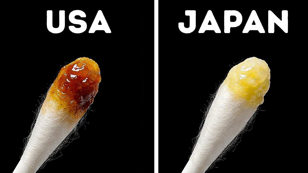 Why Asians Have Drier Ear Wax