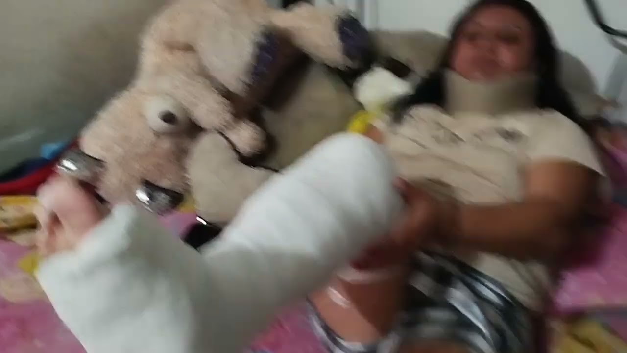 Clip 94 My wife in LONG LEG CAST AND SHORT LEG CAST