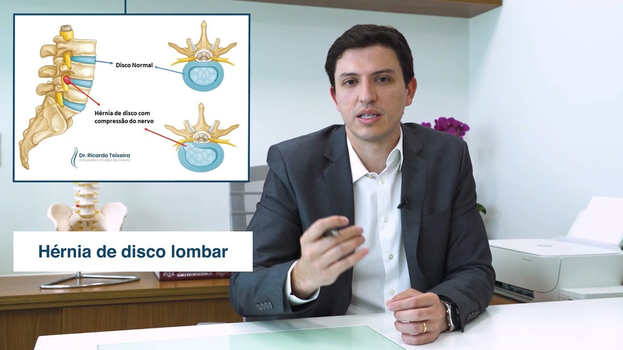 Hérnia de Disco Lombar - Dr Ricardo Teixeira